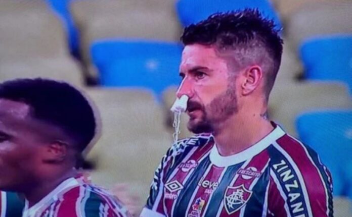 everaldo,-do-fluminense,-usa-absorvente-no-nariz-para-estancar-sangue