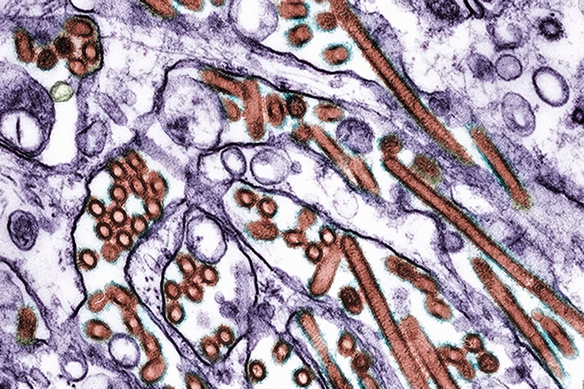 h5n1:-mexico-registra-1a-morte-por-gripe-aviaria-na-america-latina