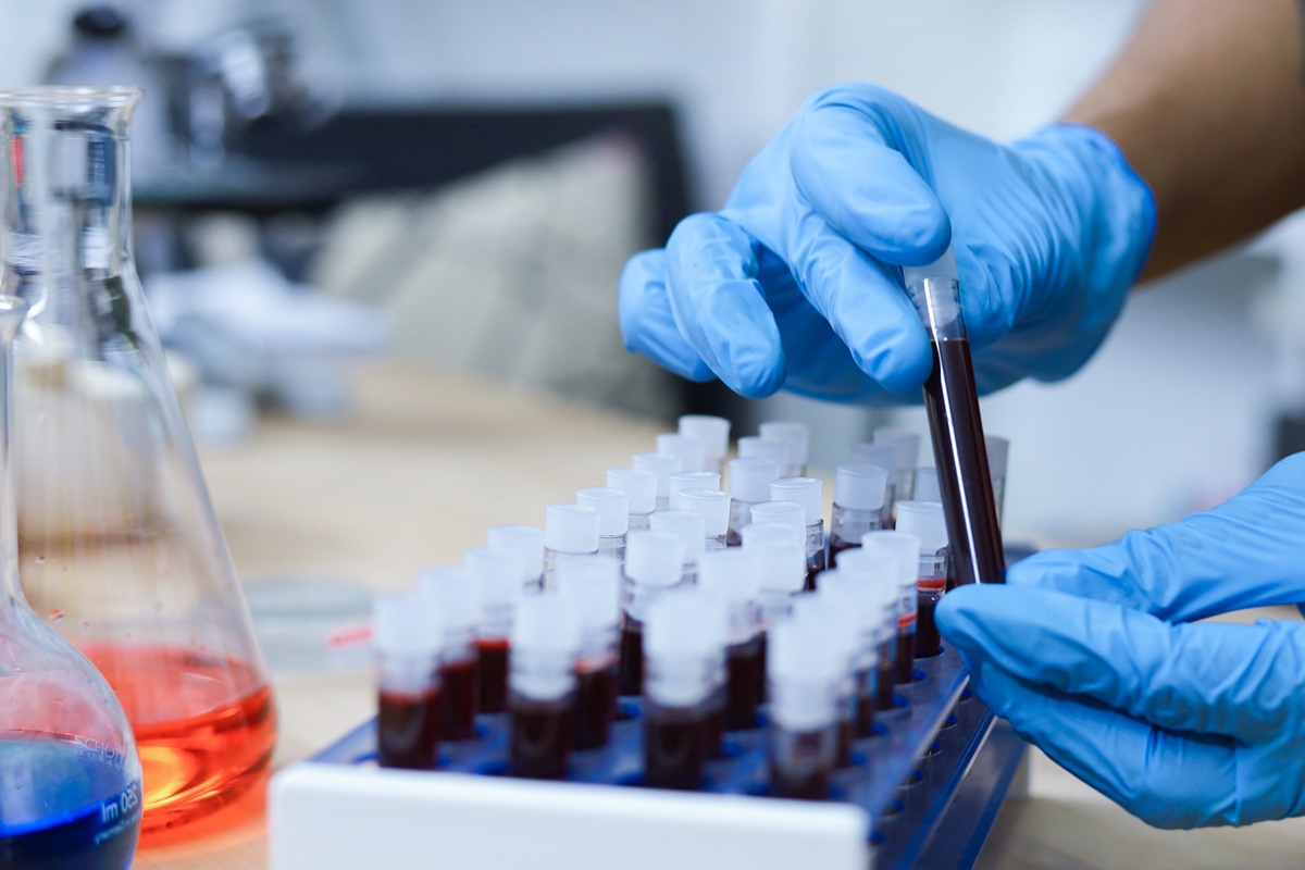 teste-de-sangue-identifica-parkinson-antes-dos-primeiros-sintomas