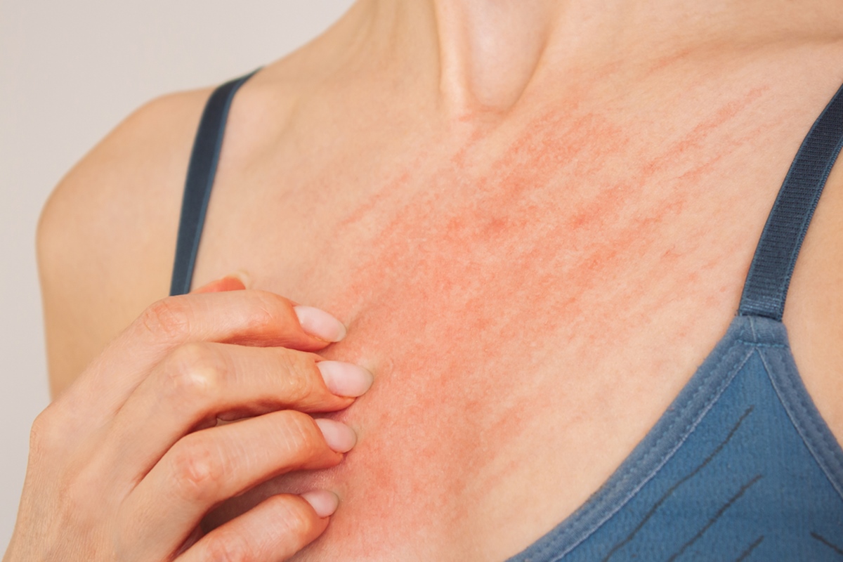 reacoes-alergicas:-o-que-fazer-diante-de-um-choque-anafilatico?