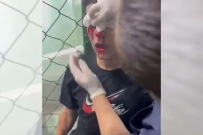 jogador-atingido-por-bomba-em-vestiario-detalha-ataque.-veja