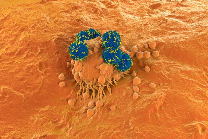 terapia-car-t-e-segura-e-nao-aumenta-risco-de-cancer-a-longo-prazo