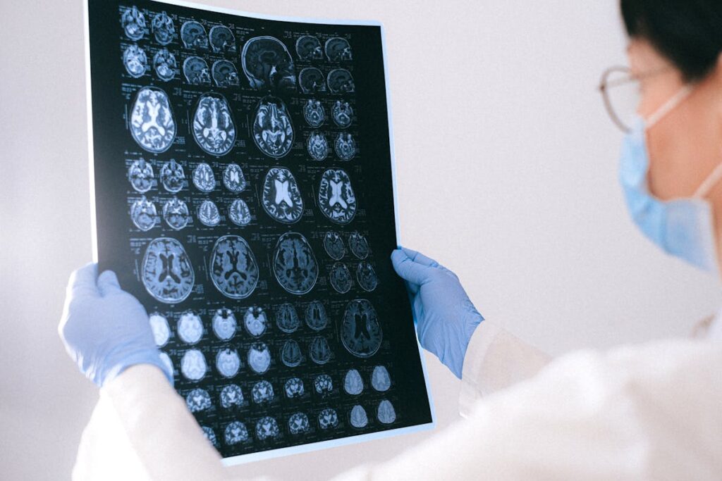estudo-consegue-prever-quando-sintomas-do-alzheimer-genetico-surgirao