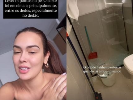 que-perigo!-ex-bbb-larissa-santos-sofre-acidente-domestico-e-leva-14-pontos-no-pe
