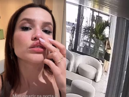 juliette-da-de-cara-em-vidro-e-mostra-como-ficou-seu-rosto-apos-acidente