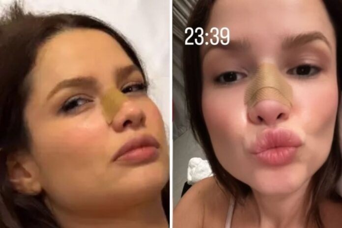 juliette-sofre-acidente-domestico-e-quebra-o-nariz.-video!