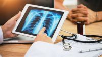 casos-de-gripe-aumentam-nas-regioes-norte-e-centro-oeste,-diz-fiocruz