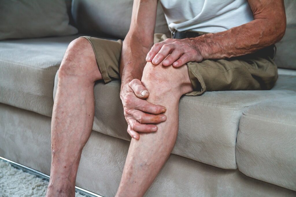 saiba-qual-e-a-relacao-entre-pes-frios-e-pernas-pesadas-com-varizes