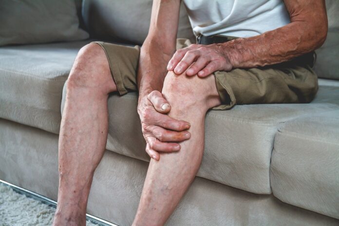 saiba-qual-e-a-relacao-entre-pes-frios-e-pernas-pesadas-com-varizes
