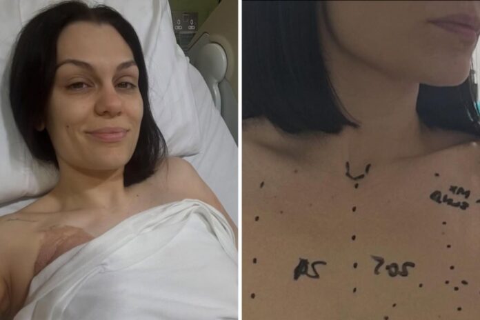 jessie-j-inicia-tratamento-contra-cancer-de-mama-e-atualiza-estado-de-saude