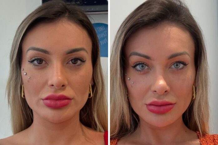 andressa-urach-faz-mudanca-definitiva-no-corpo-apos-cirurgia-na-franca