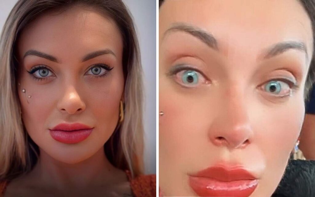 andressa-urach-se-arrepende-e-se-desespera-de-mudar-cor-dos-olhos