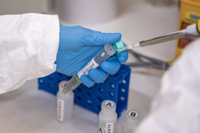 butantan-cria-dois-testes-rapidos-que-detectam-leptospirose-em-25-min