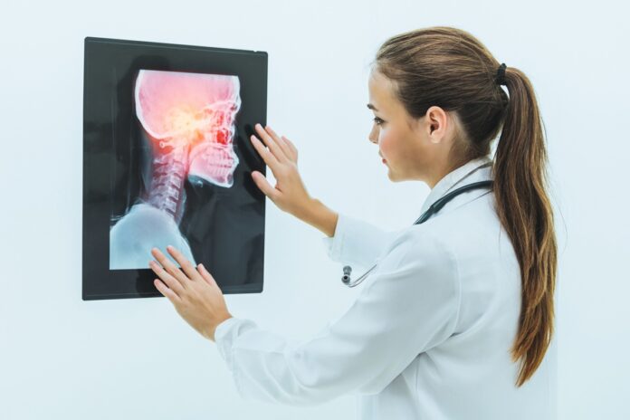 cancer-de-cabeca-e-pescoco:-tabaco,-alcool-e-hpv-aumentam-risco