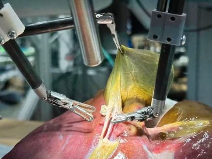 pela-1a-vez-na-historia-da-medicina,-robo-faz-cirurgia-guiada-por-ia-sem-ajuda-de-humano