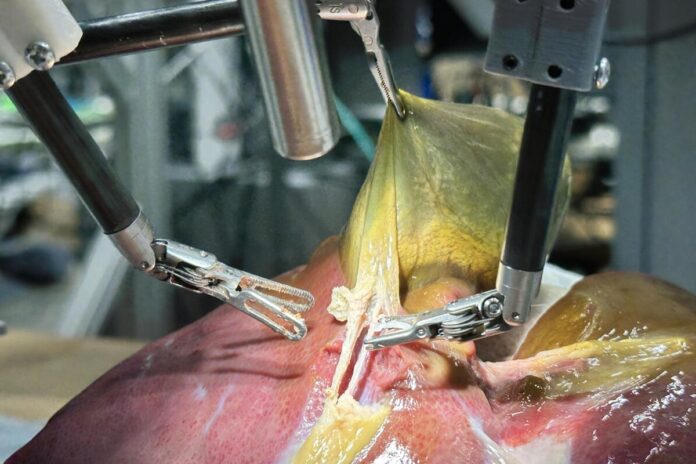 robo-faz-cirurgia-orientado-por-ia-e-sem-nenhuma-assistencia-humana