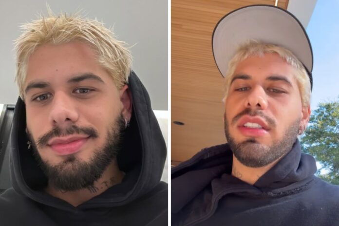 brincadeira-apos-show-termina-com-lesao-para-ze-felipe