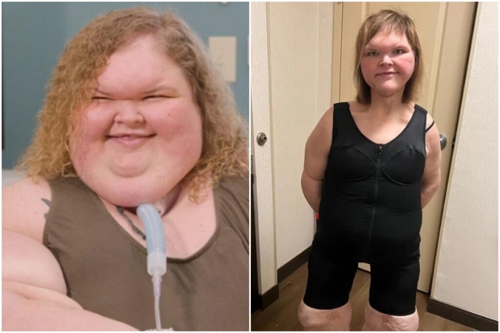 estrela-de-tv-perde-mais-de-200-kg-e-choca-com-foto-de-novo-visual