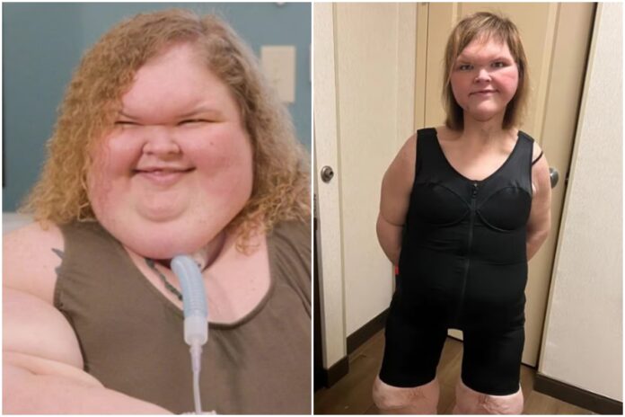 estrela-de-tv-perde-mais-de-200-kg-e-choca-com-foto-de-novo-visual