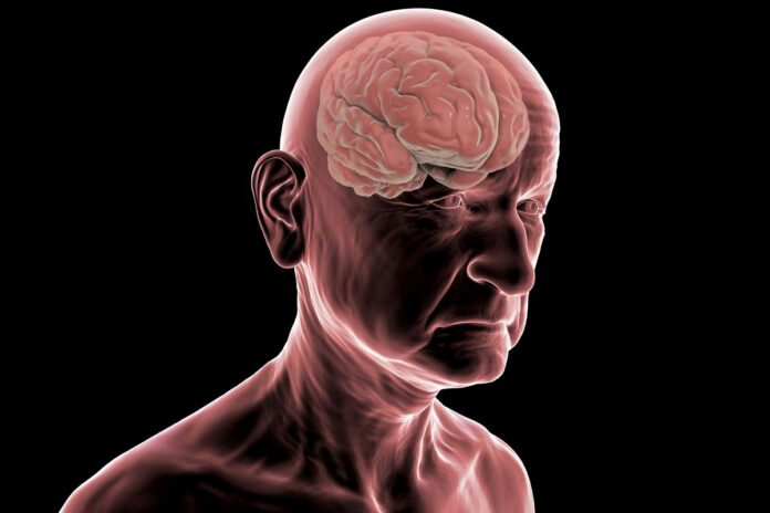 estudo:-demencia-pode-levar-mais-de-tres-anos-para-ser-diagnosticada