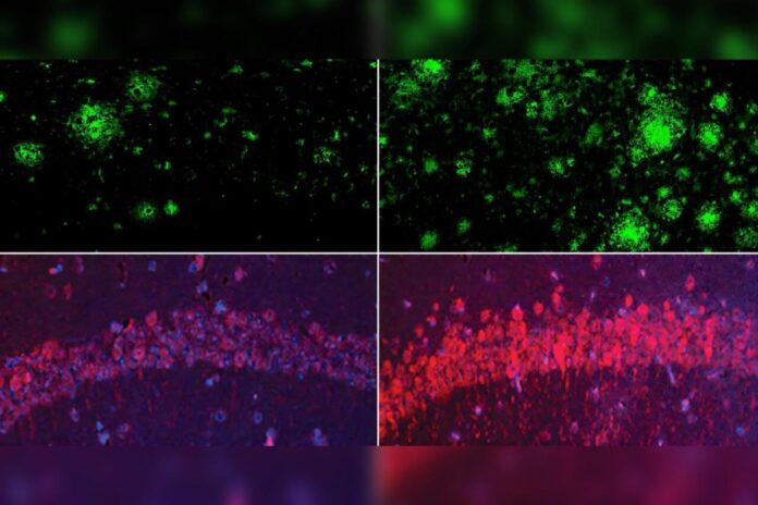 estudo-de-harvard-relaciona-perda-de-litio-no-cerebro-ao-alzheimer
