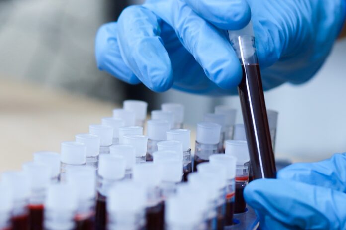 ciencia-descobre-como-reverter-envelhecimento-da-pele-com-sangue-jovem
