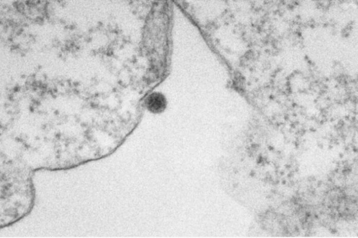 pesquisa-mostra-acao-do-virus-oropouche-em-imagens-de-microscopia