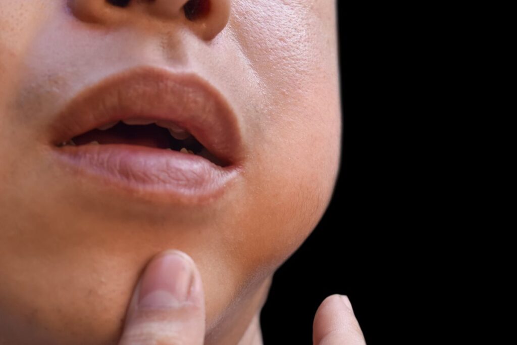 caxumba-desce?-doenca-pode-afetar-a-fertilidade-em-homens-e-mulheres