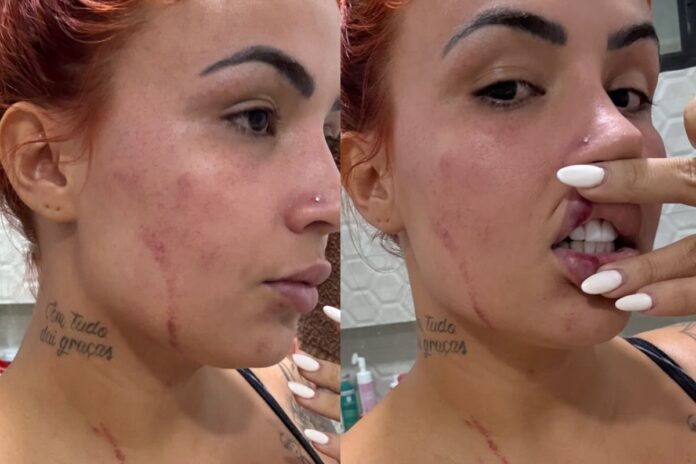 influenciadora-e-baleada-pelo-ex-marido-em-perseguicao-em-joao-pessoa