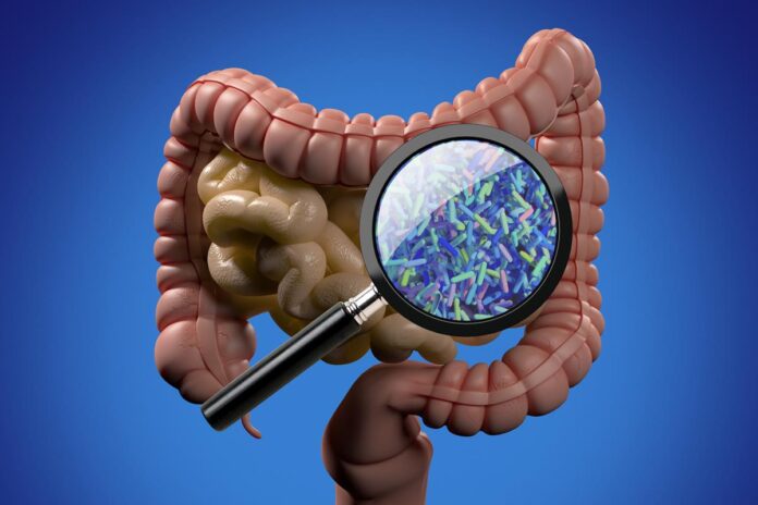 transplante-de-fezes-reduz-risco-de-sindrome-metabolica,-revela-estudo