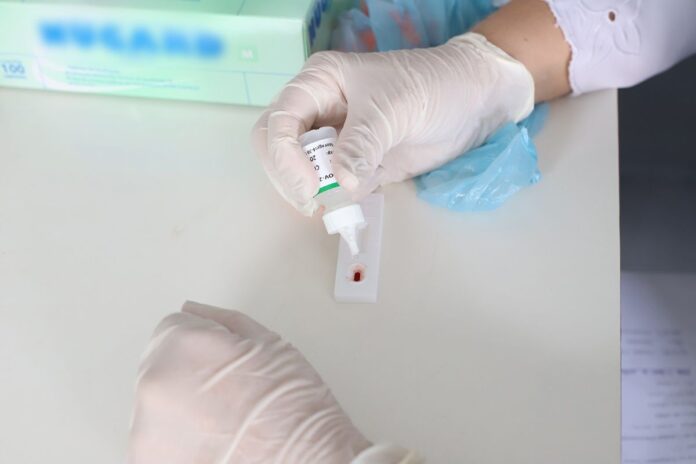 paciente-de-sp-fica-17-meses-curado-do-hiv-com-tratamento-experimental