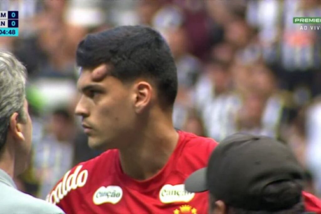 santos-atualiza-quadro-do-goleiro-gabriel-brazao.-confira