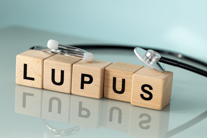 ans-inclui-remedios-contra-lupus-no-rol-de-coberturas-obrigatorias