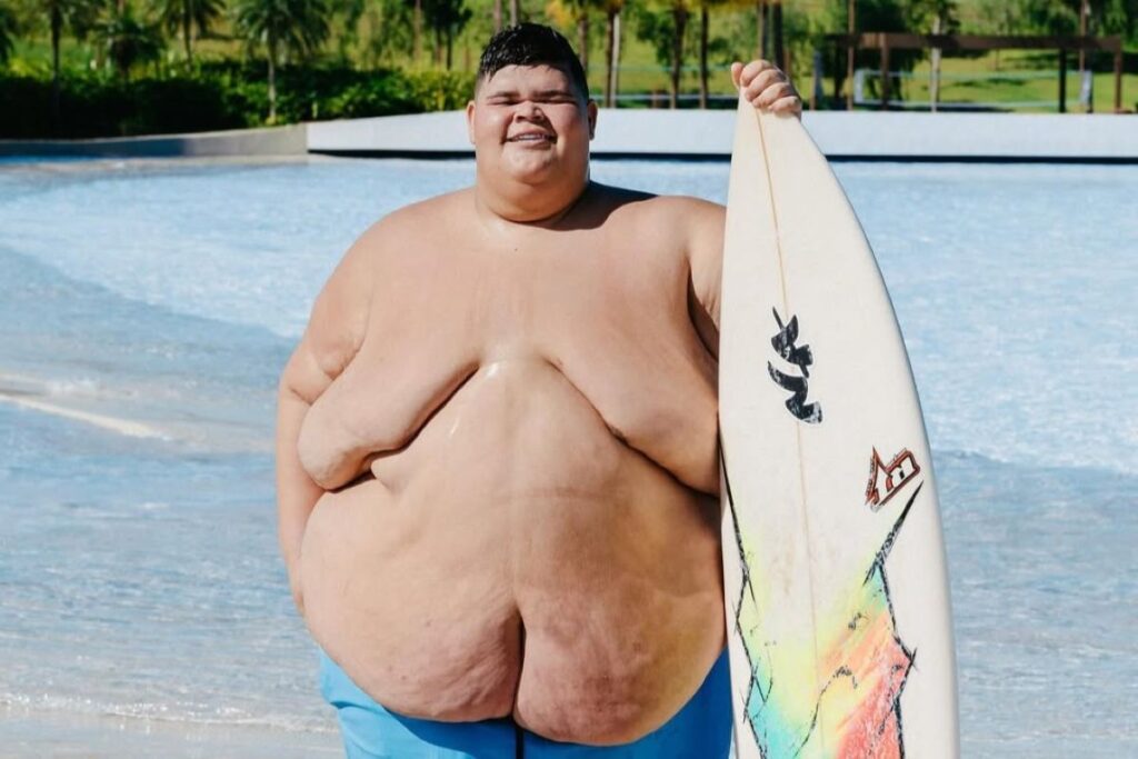 gordao-da-xj-bate-meta-e-perde-115-kg:-veja-antes-e-depois