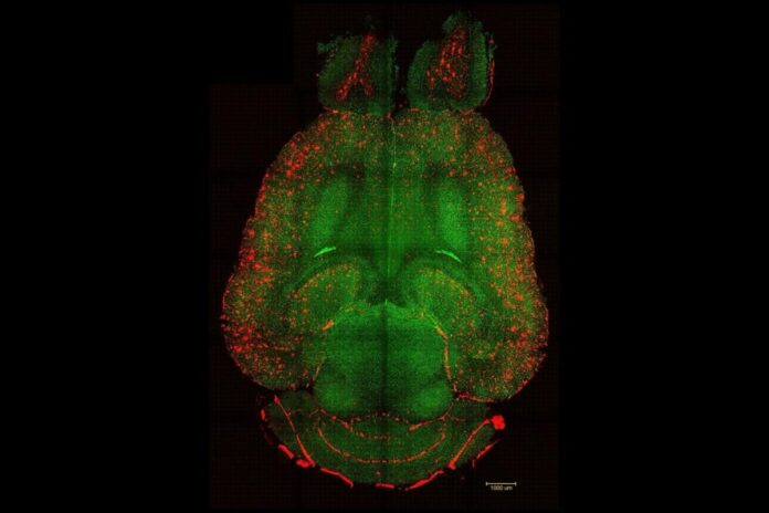 cientistas-revertem-alzheimer-em-camundongos-usando-nanoparticulas