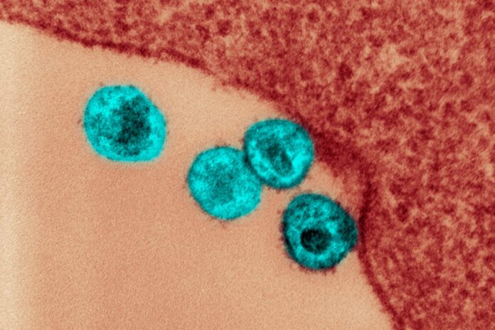 estudo-indica-em-quais-partes-do-corpo-o-hiv-se-esconde
