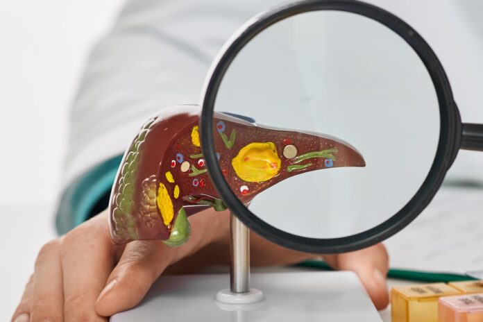 estudo:-gordura-invisivel-no-figado-afeta-as-arterias-silenciosamente