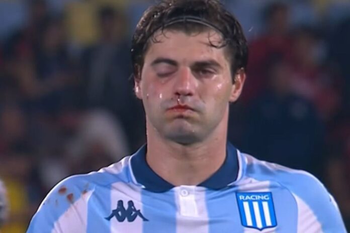 zagueiro-do-racing-tem-lesao-apos-cotovelada-em-jogo-contra-flamengo