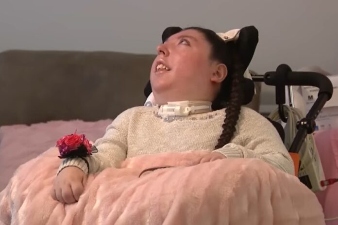 jovem-que-nasceu-sem-cerebro-desafia-a-medicina-e-completa-20-anos