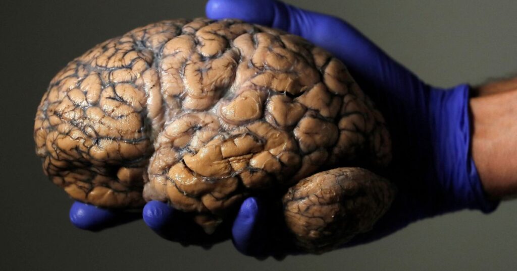 estudo-mostra-que-inflamacao-no-cerebro-pode-ser-chave-do-alzheimer