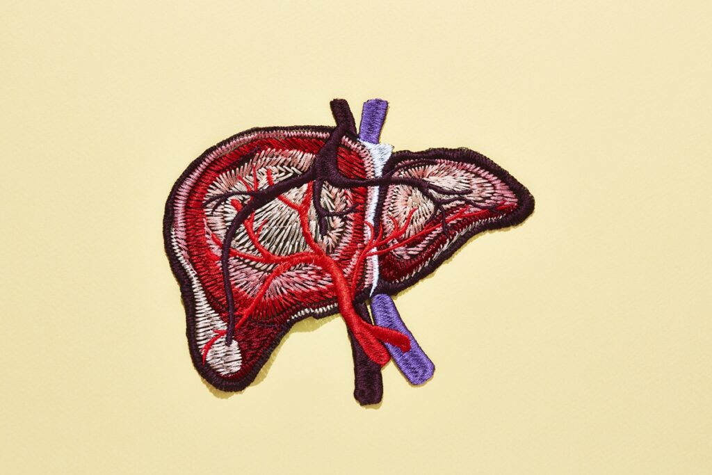 gordura-no-figado-tem-sintomas?-conheca-sinais-associados-a-condicao