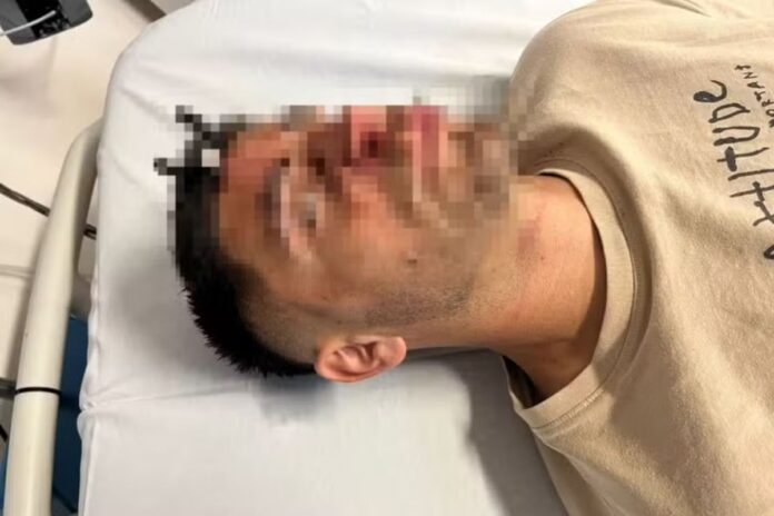 imagem-forte:-jogador-tem-chave-cravada-na-testa-apos-briga-em-estadio