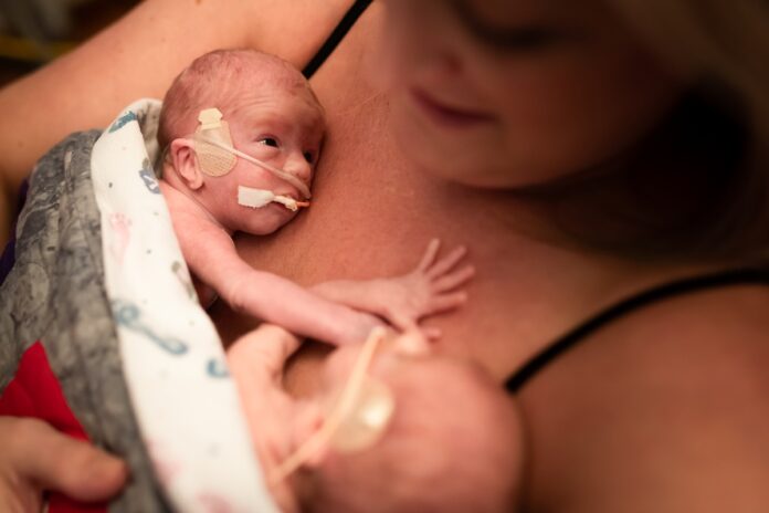 prematuridade:-veja-riscos-e-cuidados-essenciais-para-proteger-o-bebe