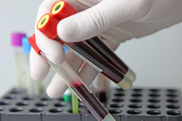 tipo-sanguineo-hibrido-raro-e-identificado-em-3-pessoas-da-tailandia