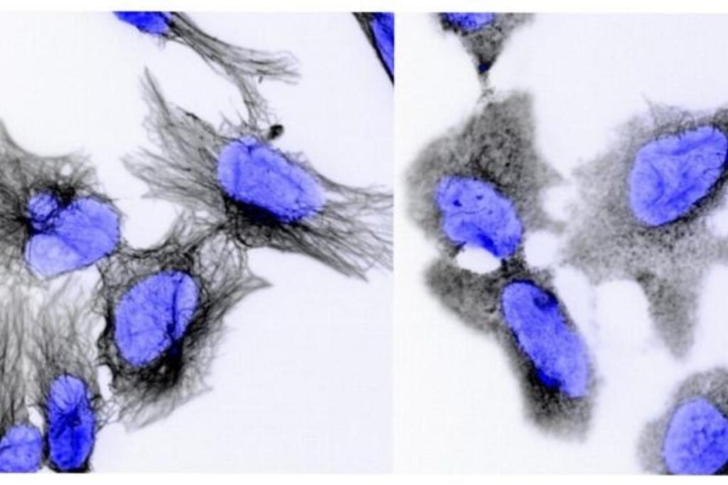 tratamento-potencial-dribla-resistencia-em-cancer-infantil-agressivo