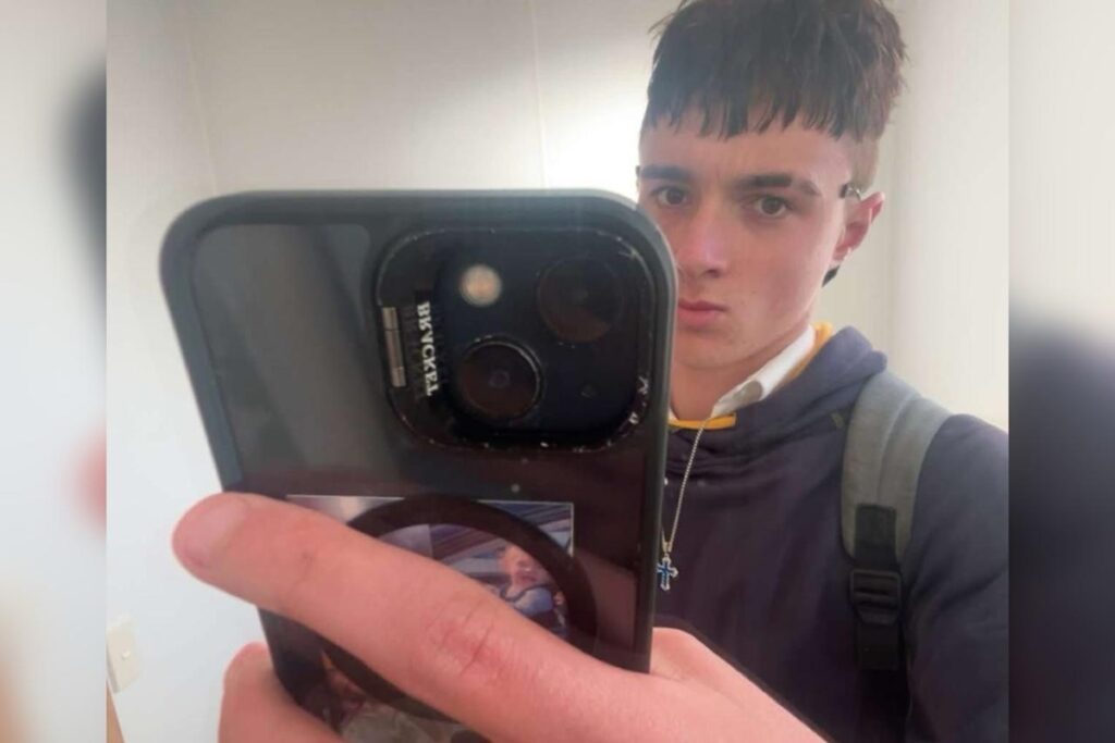 vicio-em-cigarro-eletronico-faz-adolescente-perder-pedacos-do-pulmao