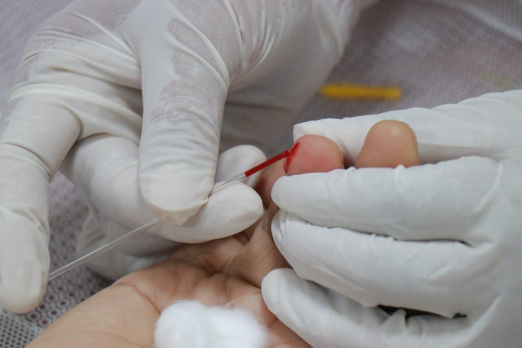 endocrinologista-explica-como-reconhecer-sinais-precoces-da-diabetes