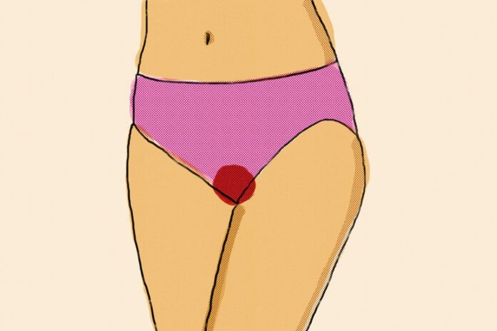 ginecologista-explica-se-fluxo-intenso-na-menstruacao-e-normal