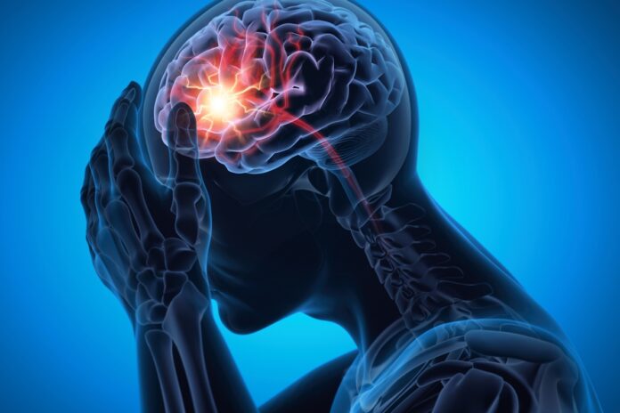 neurologistas-listam-4-habitos-que-ajudam-a-reduzir-o-risco-de-avc