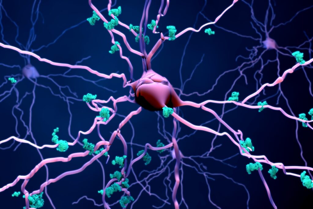 alzheimer:-medicamento-pode-reduzir-morte-de-neuronios,-indica-estudo
